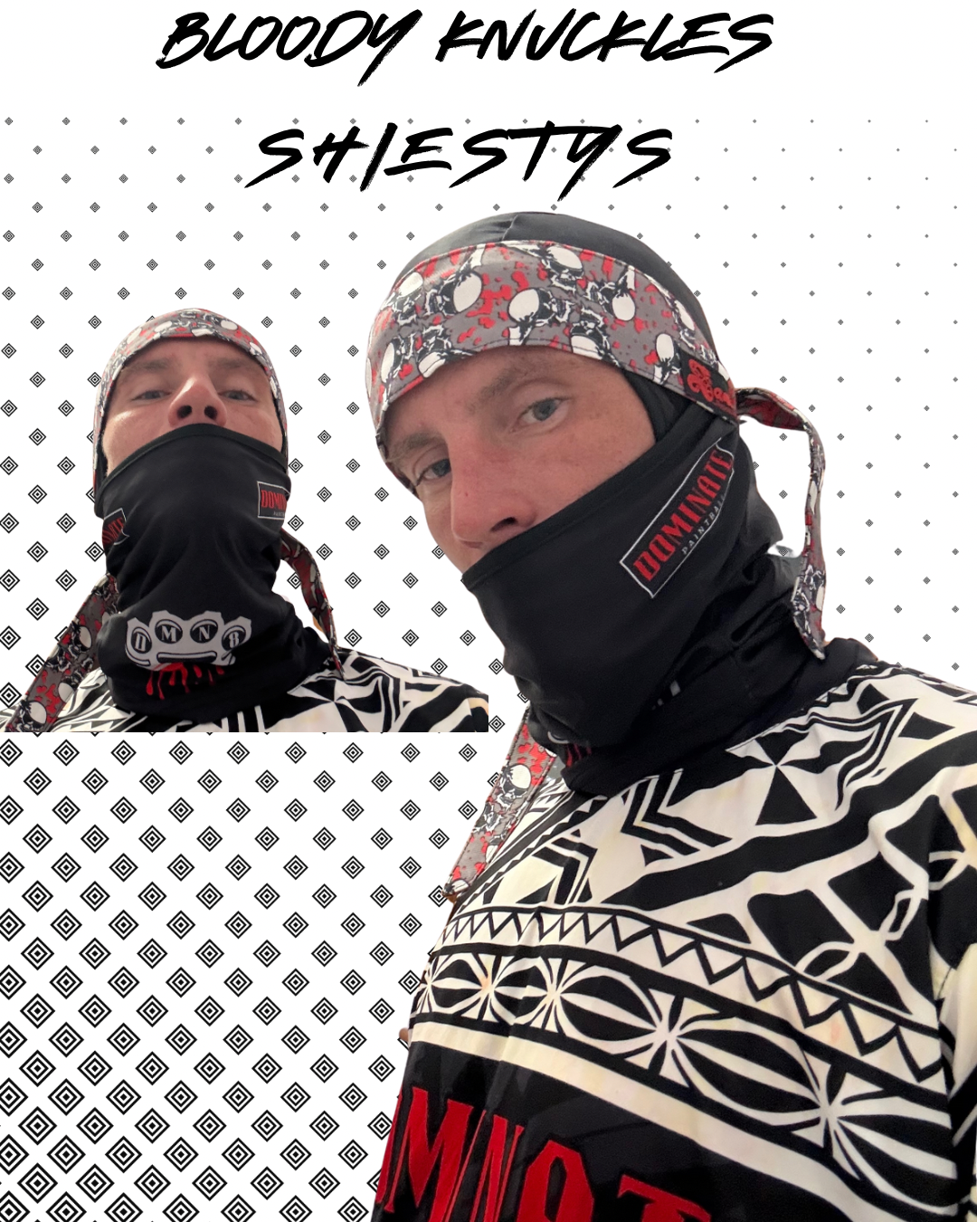 Bloody knuckle Shiesty